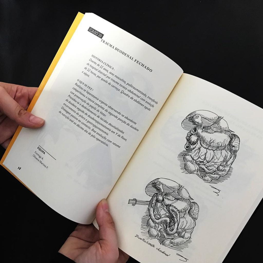 Ainda sobre o livro « Cadernos de um Cirurgião » mostramos um bocadinho do que e...